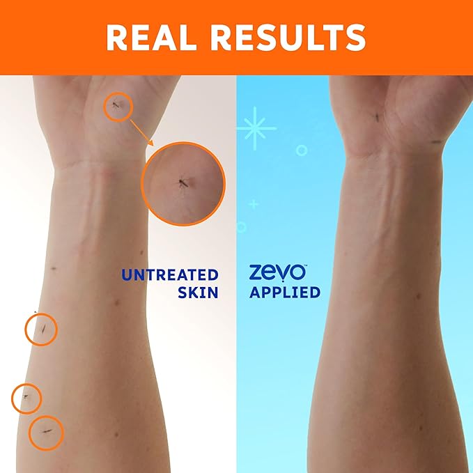 Zevo On-Body Tick & Mosquito Repellent Spray & Bug Repellent Lotion - 8 Hour Insect Protection - Odorless & Non-Sticky (1 Lotion, 1 Pump Bottle & 1 Aerosol Bottle)