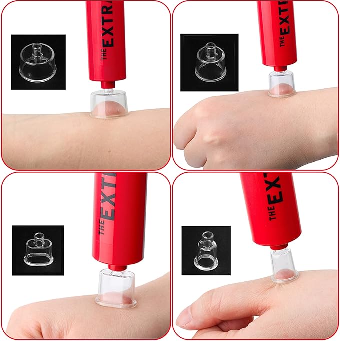 Snake Bite Kit, Bee Sting Kit, Emergency First Aid Supplies, Venom Extractor Suction Pump, Bite and Sting First Aid for Hiking, Backpacking and Camping. Includes Bonus CPR face Shield (Red)